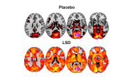 LSD Brain Imaging
