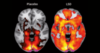 lsd brain