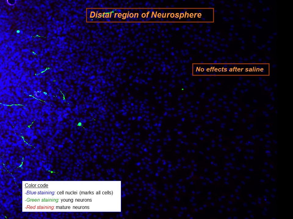 Neurogenesis_Saline
