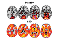 LSD Brain Imaging
