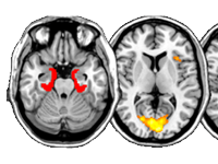 sidebar thumb - brain on lsd music.fw